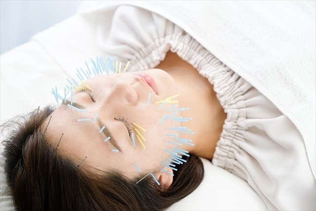 ベーシック美容鍼